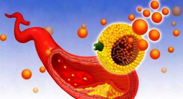 Как понизить уровень холестерина в крови без лекарств