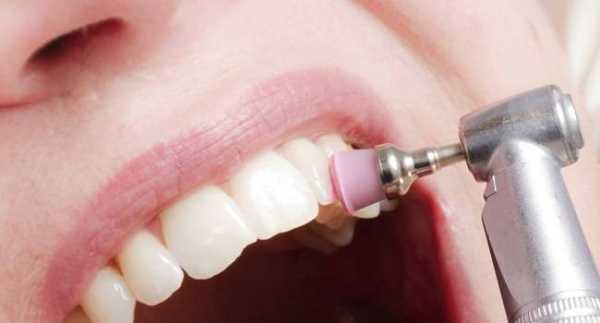 6 способов защитить зубы от кариеса