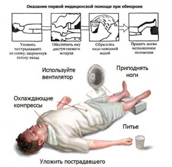 Обморок: причины, виды и профилактика