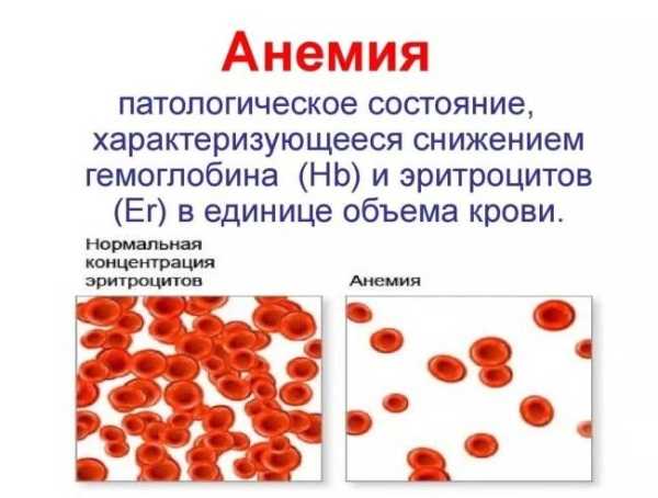 9 причин постоянной усталости