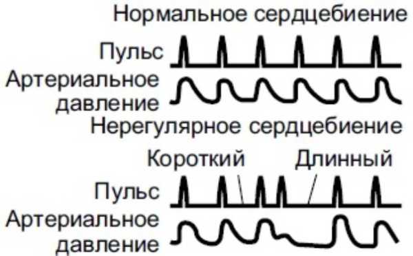 4 факта о влиянии алкоголя на сердце