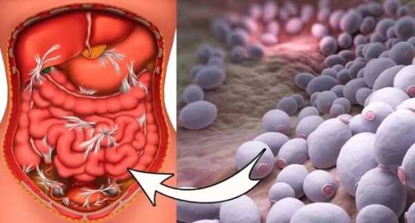 Дрожжи и ваше тело: что об этом нужно знать