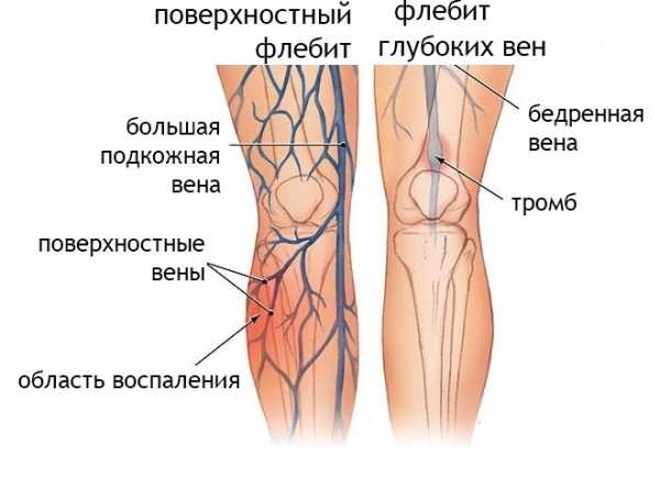 Велосипед упражнение на пресс, для ног. Техника, какие мышцы работают