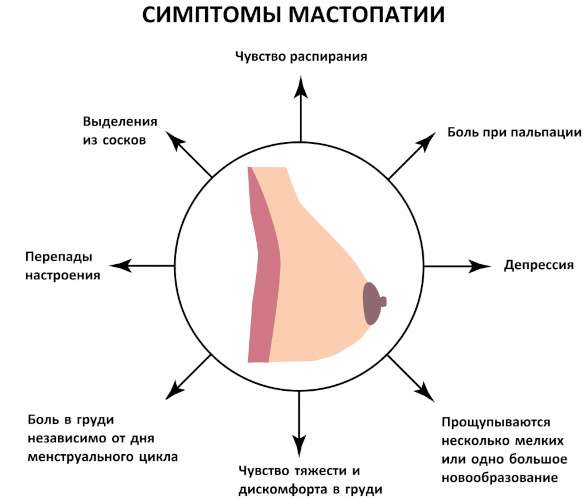 Туберозная деформация груди у женщин. Фото, как выглядит